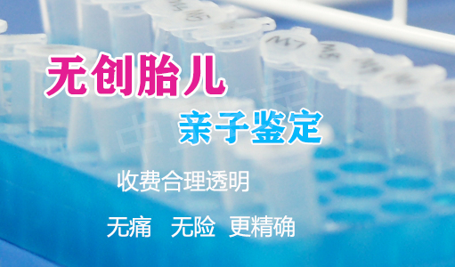 在[哈尔滨]刚怀孕怎么做血缘检测,哈尔滨怀孕亲子鉴定收费明细